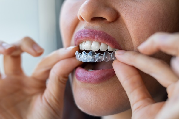 Do Clear Aligners Damage Gums?